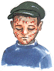 Drawing of boy with sores
